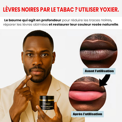 Baume à Lèvres Rosées Yoxier : Révélez Votre Sourire
