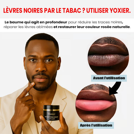 Baume à Lèvres Rosées Yoxier : Révélez Votre Sourire